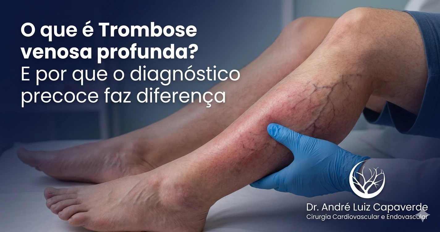 trombose venosa profunda e diagnóstico precoce em cirurgia vascular